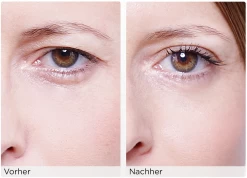 Augenlid-Liftingstripes Gr. M -hochwertige Pflegeprodukte MAM 3810469 SHOP IMAGE 1.4